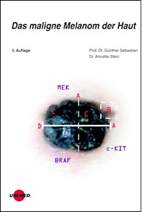 Das maligne Melanom der Haut - Sebastian Günther - E-Book