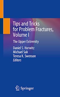 Tips and Tricks for Problem Fractures, Volume I - - E-Book