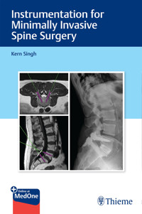 Instrumentation for Minimally Invasive Spine Surgery - Kern Singh - E-Book