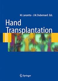 Hand transplantation -  - E-Book