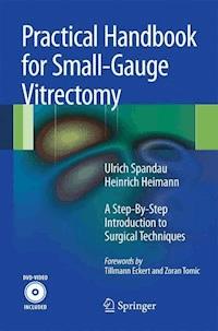 Practical Handbook for Small-Gauge Vitrectomy - Ulrich Spandau - E-Book