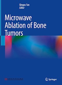 Microwave Ablation of Bone Tumors -  - E-Book