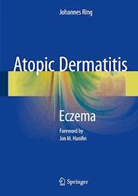 Atopic Dermatitis - Johannes Ring - E-Book