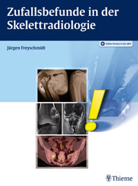 Zufallsbefunde in der Skelettradiologie - Jürgen Freyschmidt - E-Book