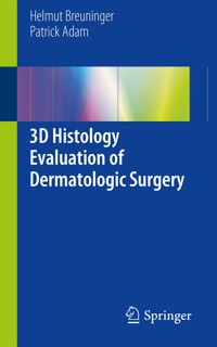 3D Histology Evaluation of Dermatologic Surgery - Helmut Breuninger - E-Book