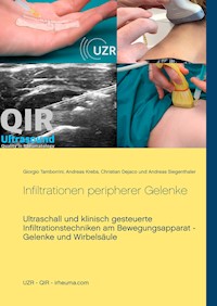 Infiltrationen peripherer Gelenke - Giorgio Tamborrini - E-Book
