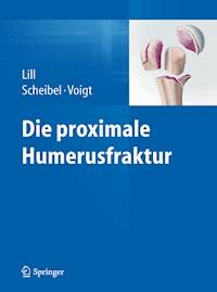 Die proximale Humerusfraktur -  - E-Book