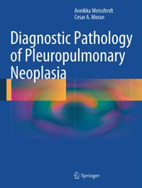 Diagnostic Pathology of Pleuropulmonary Neoplasia - Annikka Weissferdt - E-Book