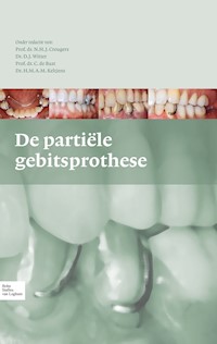 De partiële gebitsprothese - N.H.J. Creugers - E-Book