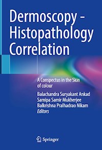 Dermoscopy - Histopathology Correlation -  - E-Book