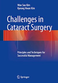 Challenges in Cataract Surgery - Wan Soo Kim - E-Book