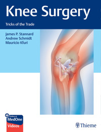 Knee Surgery - James Stannard - E-Book