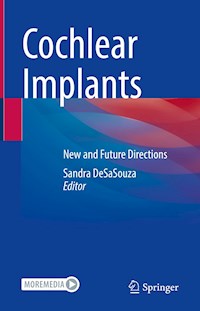 Cochlear Implants -  - E-Book