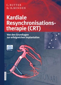 Kardiale Resynchronisationstherapie (CRT) - Christian Butter - E-Book