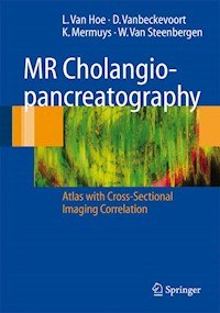 MR Cholangiopancreatography - L. van Hoe - E-Book