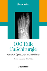 100 Fälle Fußchirurgie - - E-Book