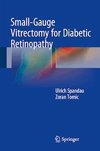 Small-Gauge Vitrectomy for Diabetic Retinopathy - Ulrich Spandau - E-Book