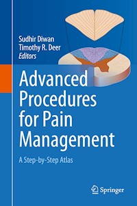 Advanced Procedures for Pain Management -  - E-Book