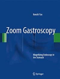 Zoom Gastroscopy - Kenshi Yao - E-Book