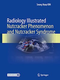 Radiology Illustrated: Nutcracker Phenomenon and Nutcracker Syndrome - Seung Hyup Kim - E-Book