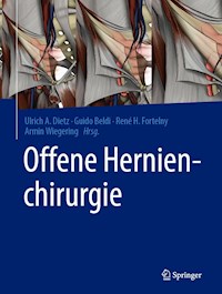 Offene Hernienchirurgie -  - E-Book