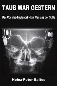 TAUB WAR GESTERN - Heinz-Peter Baltes - E-Book
