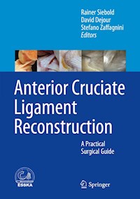 Anterior Cruciate Ligament Reconstruction -  - E-Book