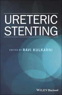 Ureteric Stenting -  - E-Book