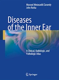Diseases of the Inner Ear -  - E-Book