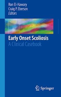 Early Onset Scoliosis -  - E-Book