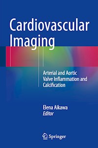 Cardiovascular Imaging -  - E-Book