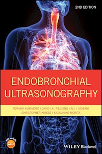 Endobronchial Ultrasonography - Noriaki Kurimoto - E-Book