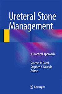 Ureteral Stone Management -  - E-Book