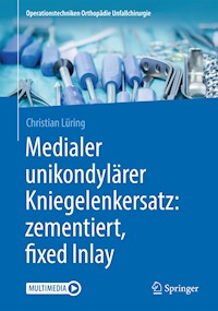 Medialer unikondylärer Kniegelenkersatz: zementiert, fixed Inlay - Christian Lüring - E-Book