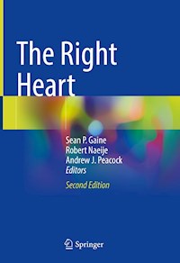 The Right Heart -  - E-Book