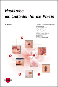 Hautkrebs - ein Leitfaden für die Praxis - Eggert Stockfleth - E-Book