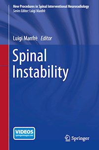 Spinal Instability -  - E-Book