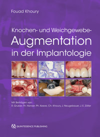 Knochen- und Weichgewebeaugmentation in der Implantologie -  - E-Book