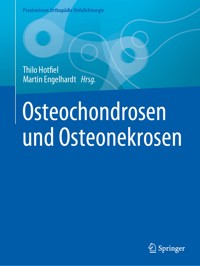 Osteochondrosen und Osteonekrosen - - E-Book