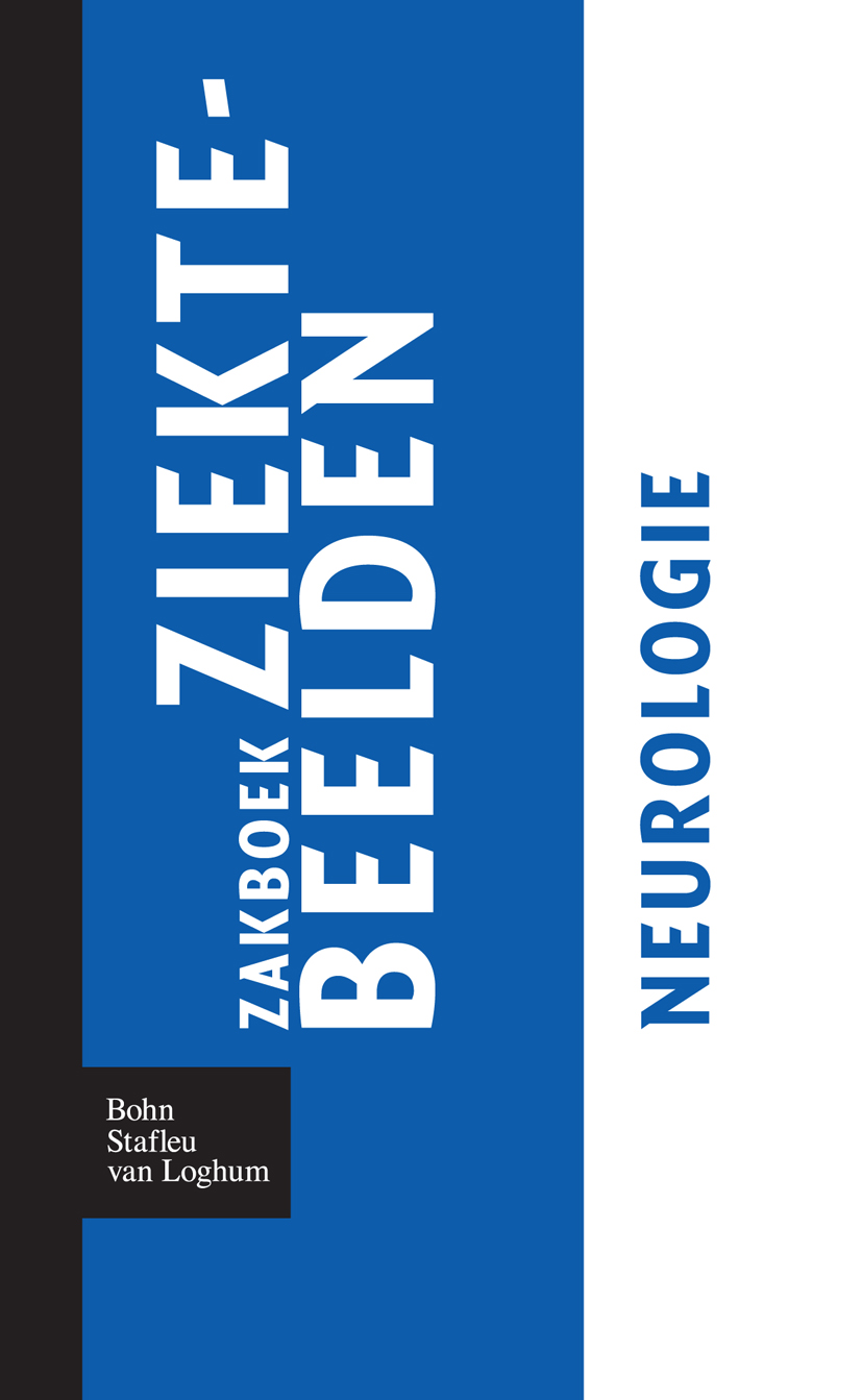 Zakboek ziektebeelden Neurologie - Karin Linden - E-Book
