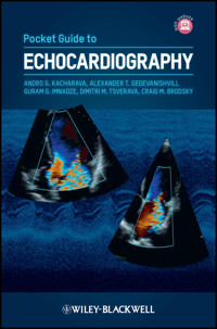 Pocket Guide to Echocardiography -  - E-Book