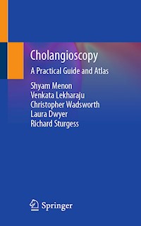 Cholangioscopy - Shyam Menon - E-Book