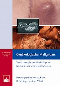 Gynäkologische Malignome -  - E-Book