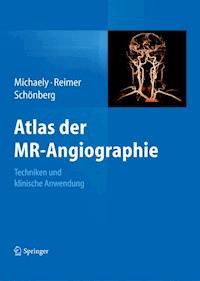 Atlas der MR-Angiographie - - E-Book