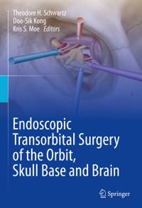 Endoscopic Transorbital Surgery of the Orbit, Skull Base and Brain -  - E-Book