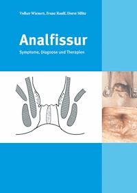 Analfissur - Franz Raulf - E-Book