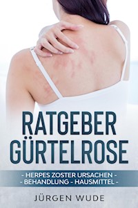 Ratgeber Gürtelrose - Jürgen Wude - E-Book