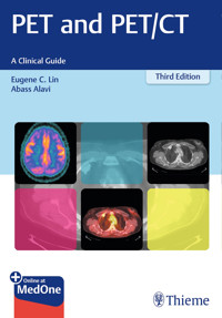 PET and PET/CT - Eugene C. Lin - E-Book