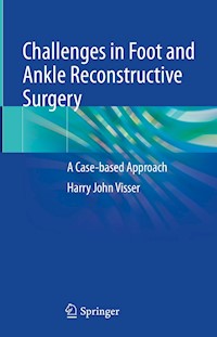 Challenges in Foot and Ankle Reconstructive Surgery - Harry J. Visser - E-Book
