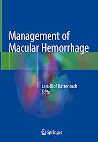 Management of Macular Hemorrhage -  - E-Book